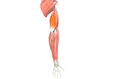 Triceps Tendonitis